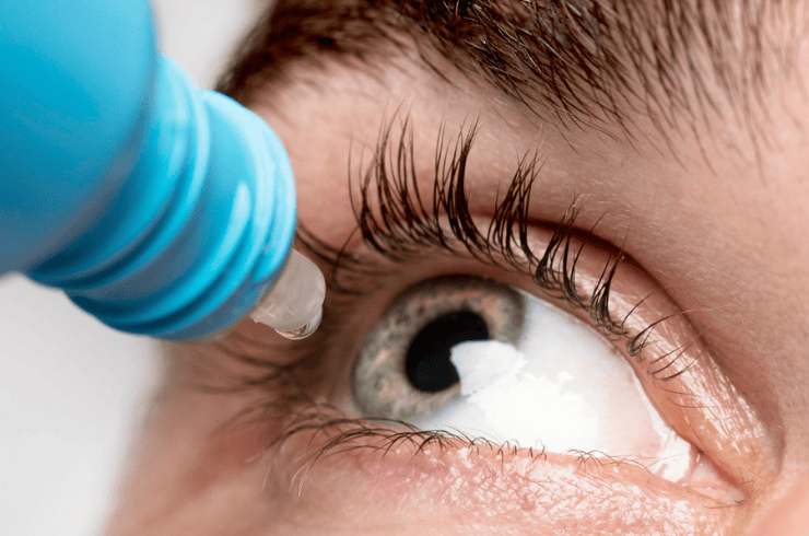 Glaucoma Services